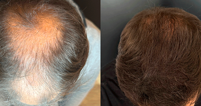 Atelier Pelo